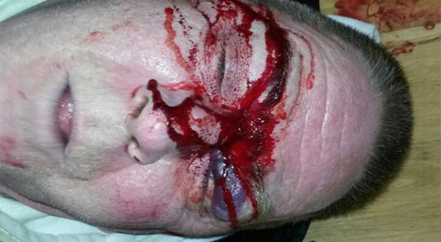 SECURITY GUARD SUSPENDED FOLLOWING ASSAULT ACCUSATION