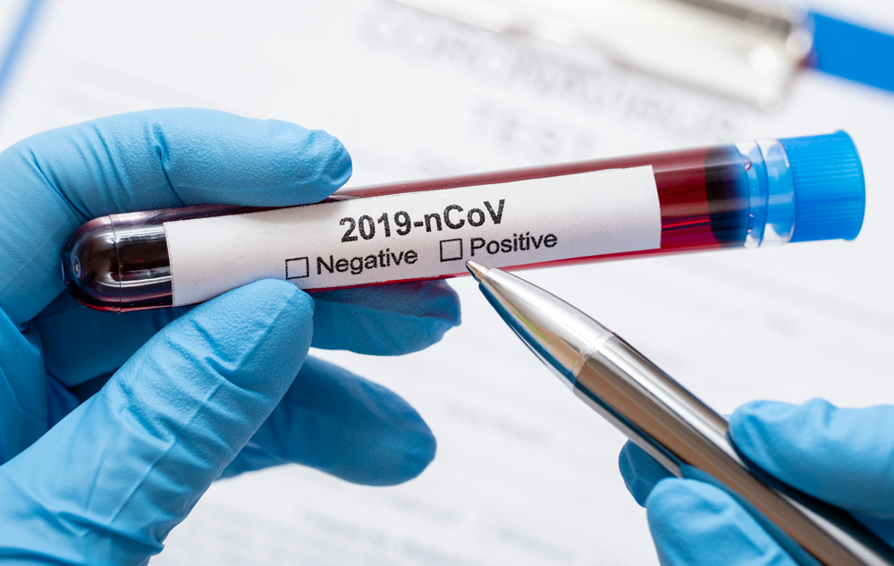 FURTHER CASES OF CORONAVIRUS IDENTIFIED ON THE ISLAND