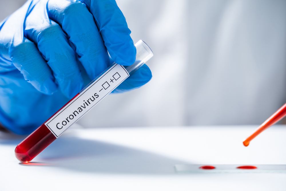 CORONAVIRUS CASES TOTAL RISES TO 74 BUT 20 PEOPLE HAVE NOW RECOVERED