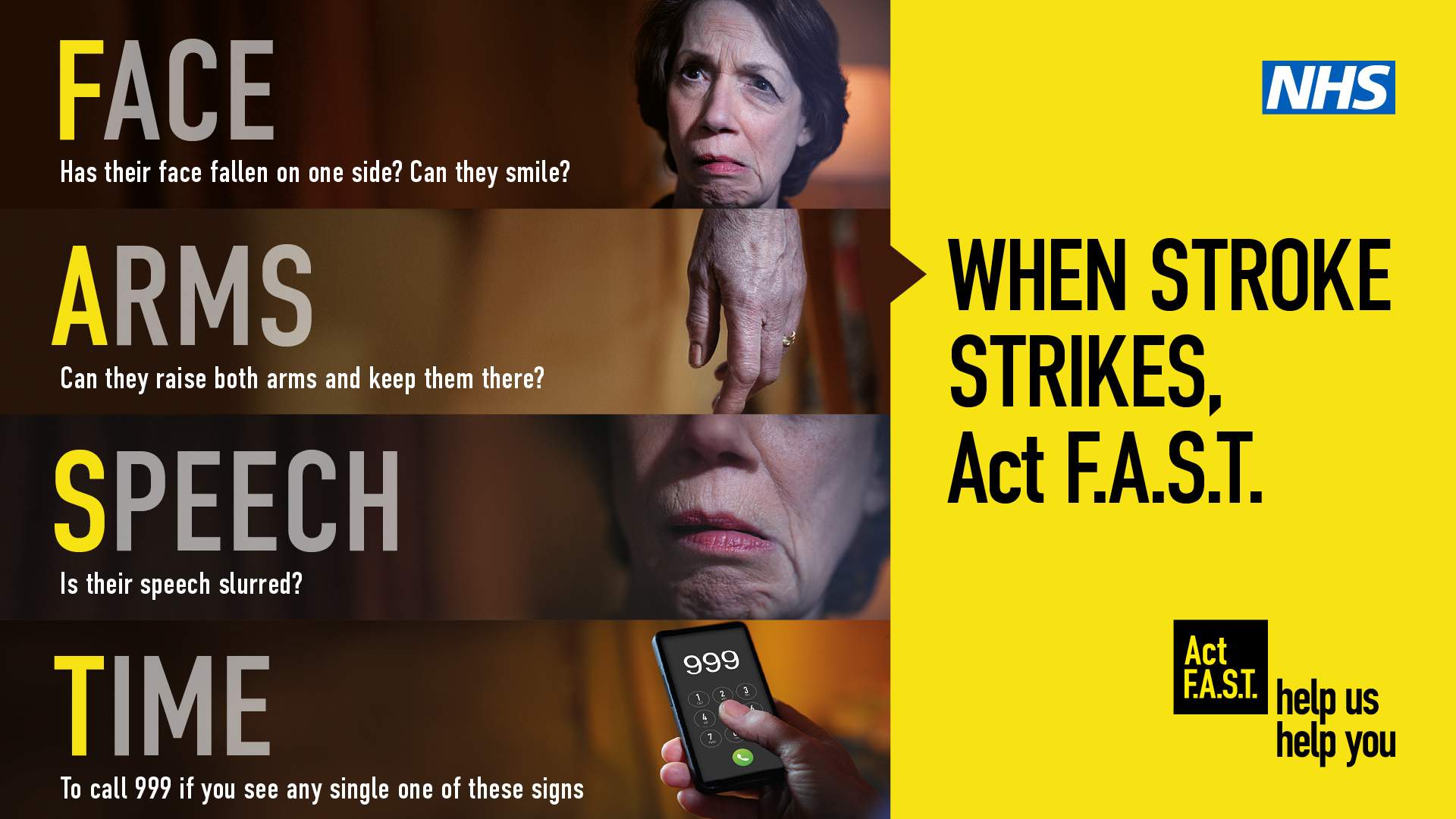 ACT F.A.S.T – PEOPLE PUT OFF SEEKING HELP FOR STROKE DURING EARLY STAGES OF PANDEMIC