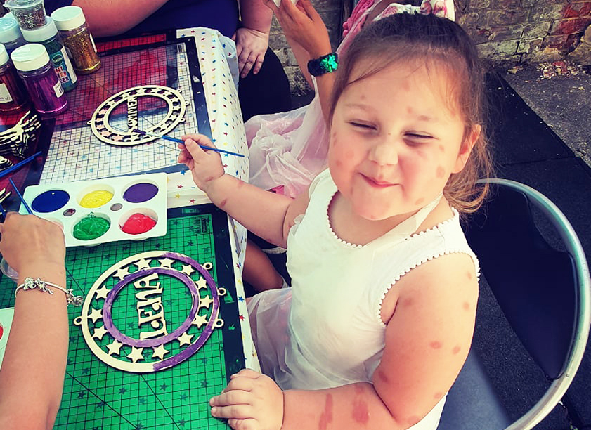 MOTHER OF GIRL WITH LIFE-LONG SKIN CONDITION AIMS TO END THE STIGMA