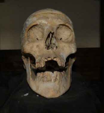 Michal Morey's Skull