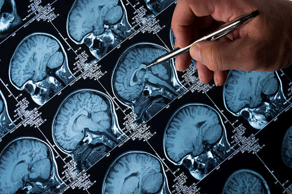 Brainscanstock