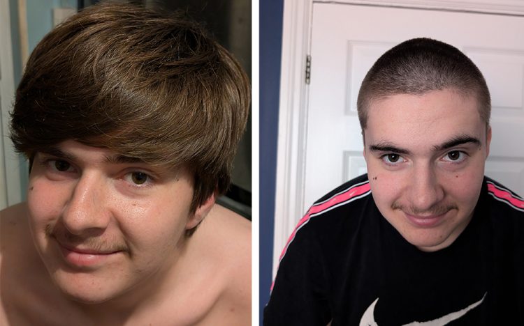 GRANDSON SHAVES HAIR TO HELP NAN’S CANCER BATTLE