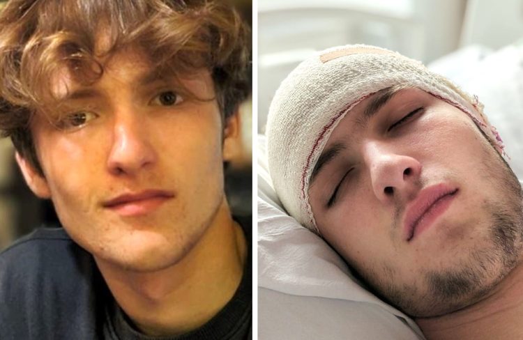 ISLAND FAMILY RAISES OVER £36,000 FOR TEENAGE SON WITH BRAIN TUMOUR