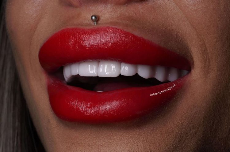WHAT IS HOLLYWOOD SMILE?