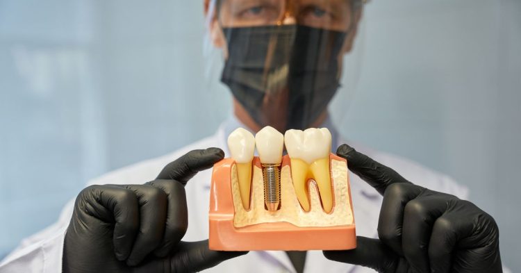WHAT ARE THE OPTIONS FOR REPLACING MISSING TEETH?