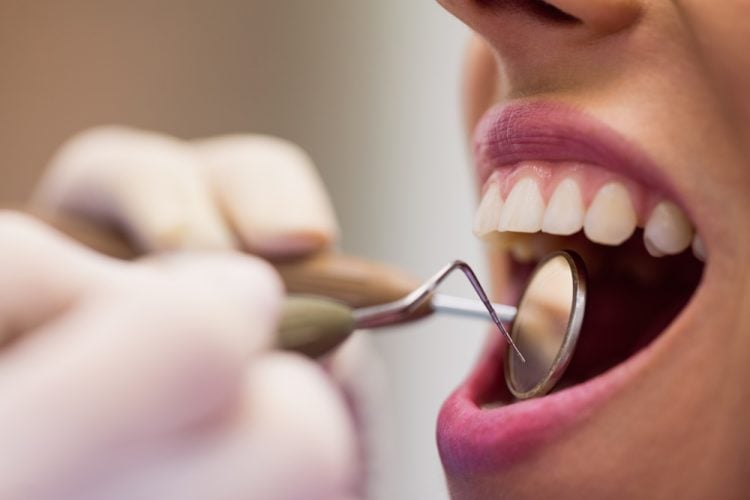 THE IMPORTANCE OF HAVING A RELIABLE EMERGENCY DENTIST