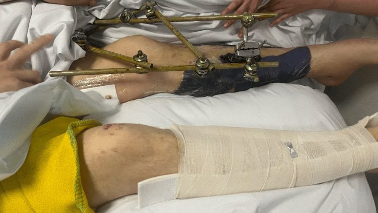 FUNDRAISER LAUNCHED FOR MOTORCYCLIST FACING AMPUTATION AFTER BROOK CRASH