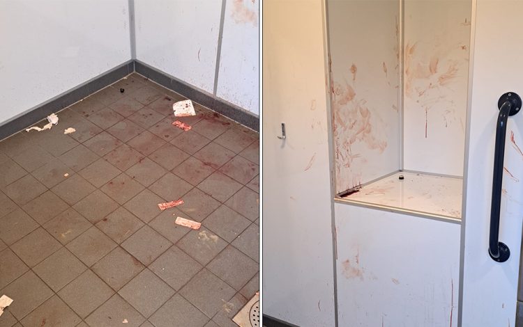 VANDALS STRIKE AGAIN AT LAKE TOILETS AS BLOOD SMEARED AND FIRE ATTEMPTED