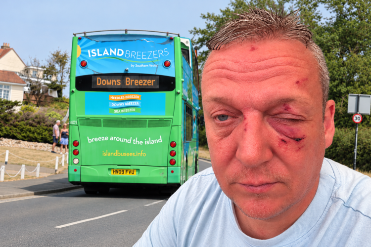 EXCLUSIVE: HOLIDAYMAKER ON BUS LEFT WITH EYE SWOLLEN SHUT – BUT NOBODY WILL ACCEPT BLAME